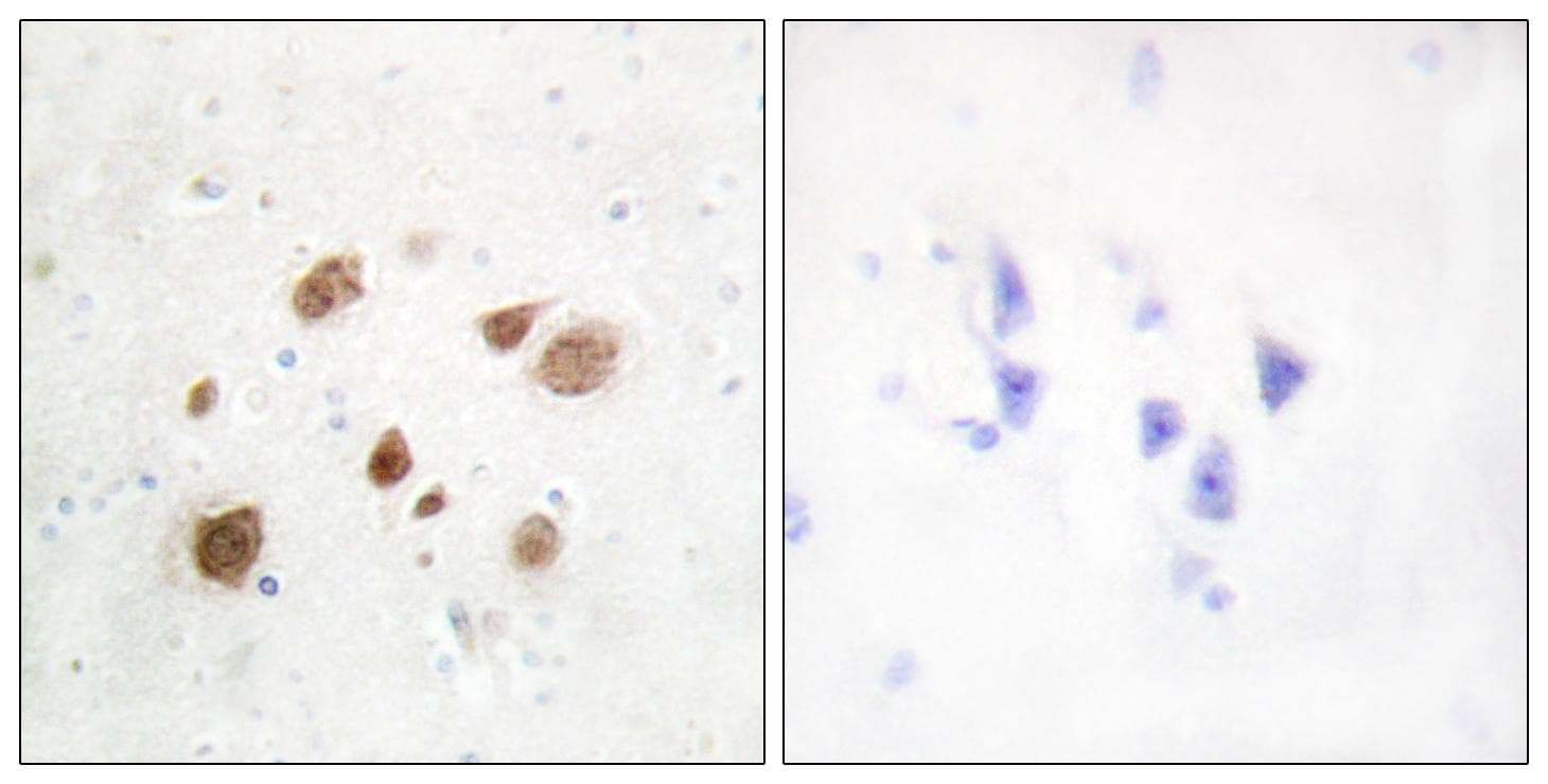Polyclonal Rabbit anti-Human PNCK / CaMK1b Antibody (IHC, WB)