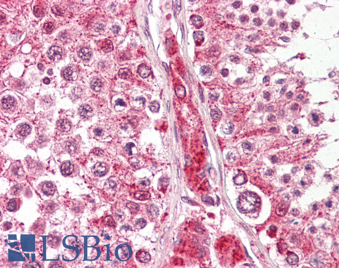 PathPlus™ GLUL / Glutamine Synthetase Antibody