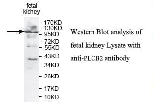 PLCB2 Antibody (aa1-198)