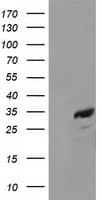 CTDSP1 / SCP1 Antibody (clone OTI1C3)