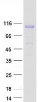 Human c-CBL Protein (Recombinant Myc-DDK (Flag))