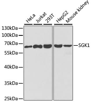 SGK1 / SGK Antibody