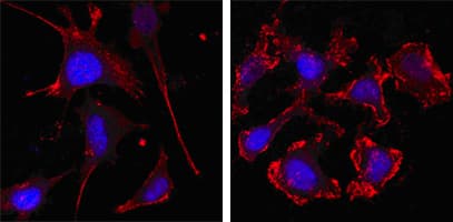 IHC-plus™ Monoclonal Mouse anti-Human ACTB / Beta Actin Antibody (clone 8H10D10, IHC, IF, WB)
