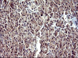 SERPINB3 Antibody (clone OTI2B11)