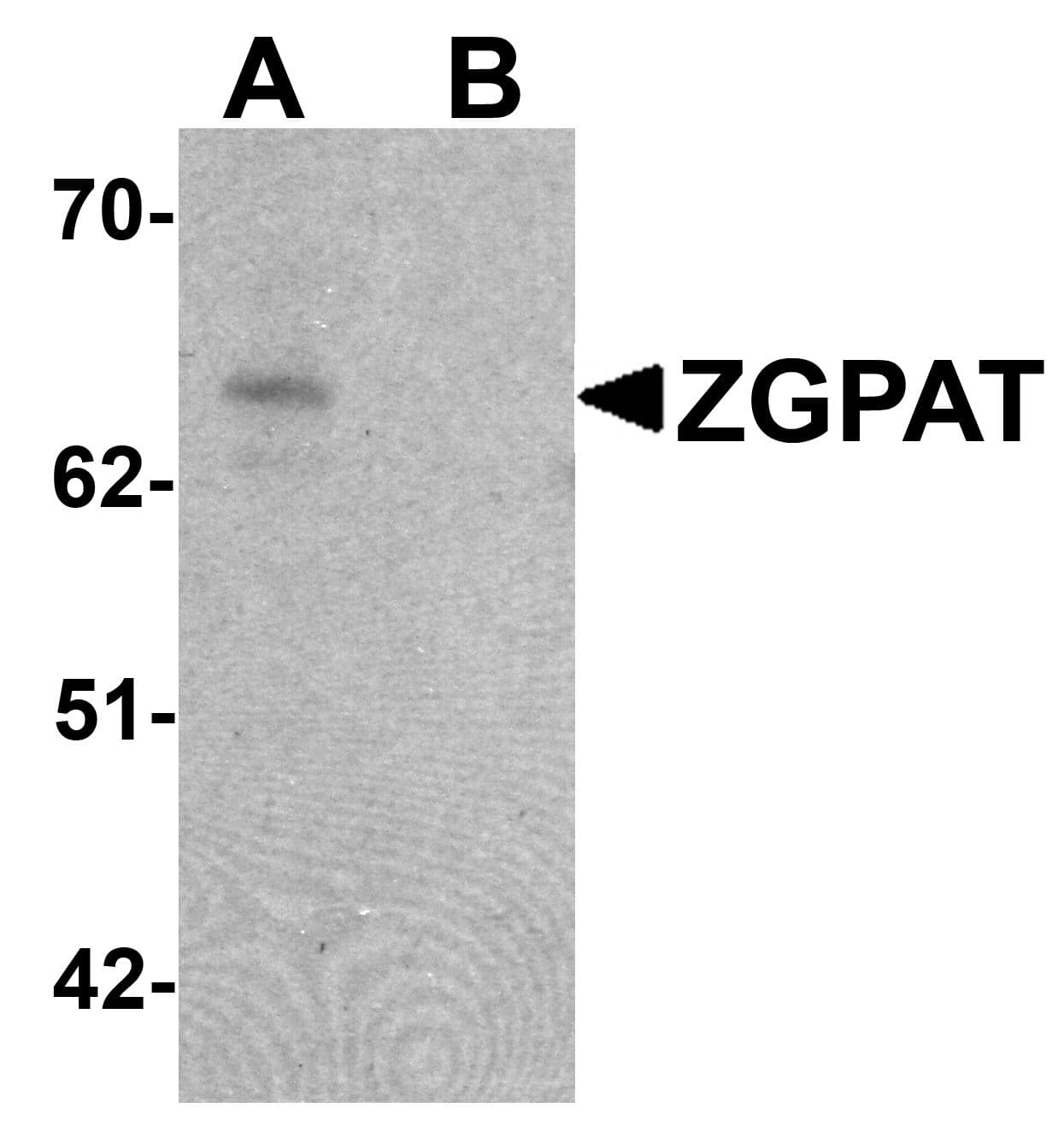 IHC-plus™ Polyclonal Chicken anti-Human ZGPAT Antibody (IHC, IF, WB)