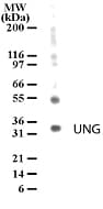 IHC-plus™ UNG / Uracil DNA Glycosylase Antibody (aa281-298)