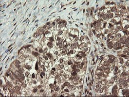 MME / CD10 Antibody (clone OTI3D11)