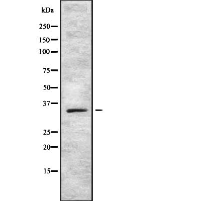 Polyclonal Rabbit anti-Human SOX12 Antibody (IF, WB)