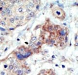 EPHB3 / EPH Receptor B3 Antibody (aa29-59)