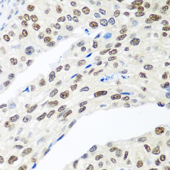 Polyclonal Rabbit anti-Human MDC1 Antibody (IHC, WB)