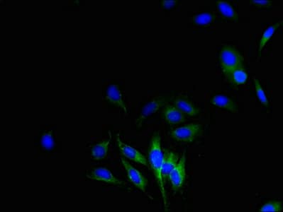 CYBB / NOX2 / gp91phox Antibody (aa283-570)
