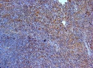 IL23R Antibody (aa59-87)