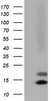 FSHB / FSH Beta Antibody (clone OTI4B9)