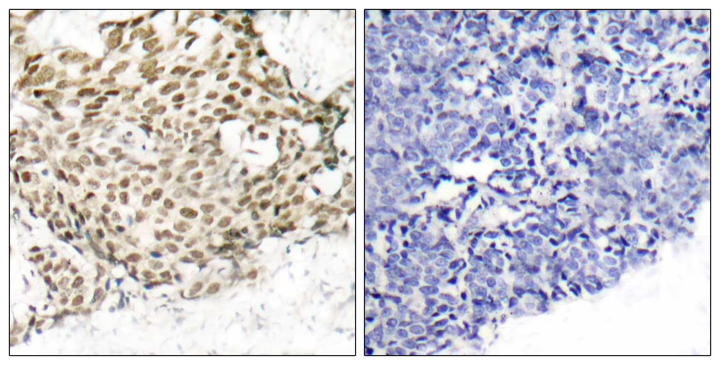 NBN / Nibrin Antibody (aa310-359)