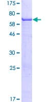 Human AMDHD1 Protein (Recombinant GST)