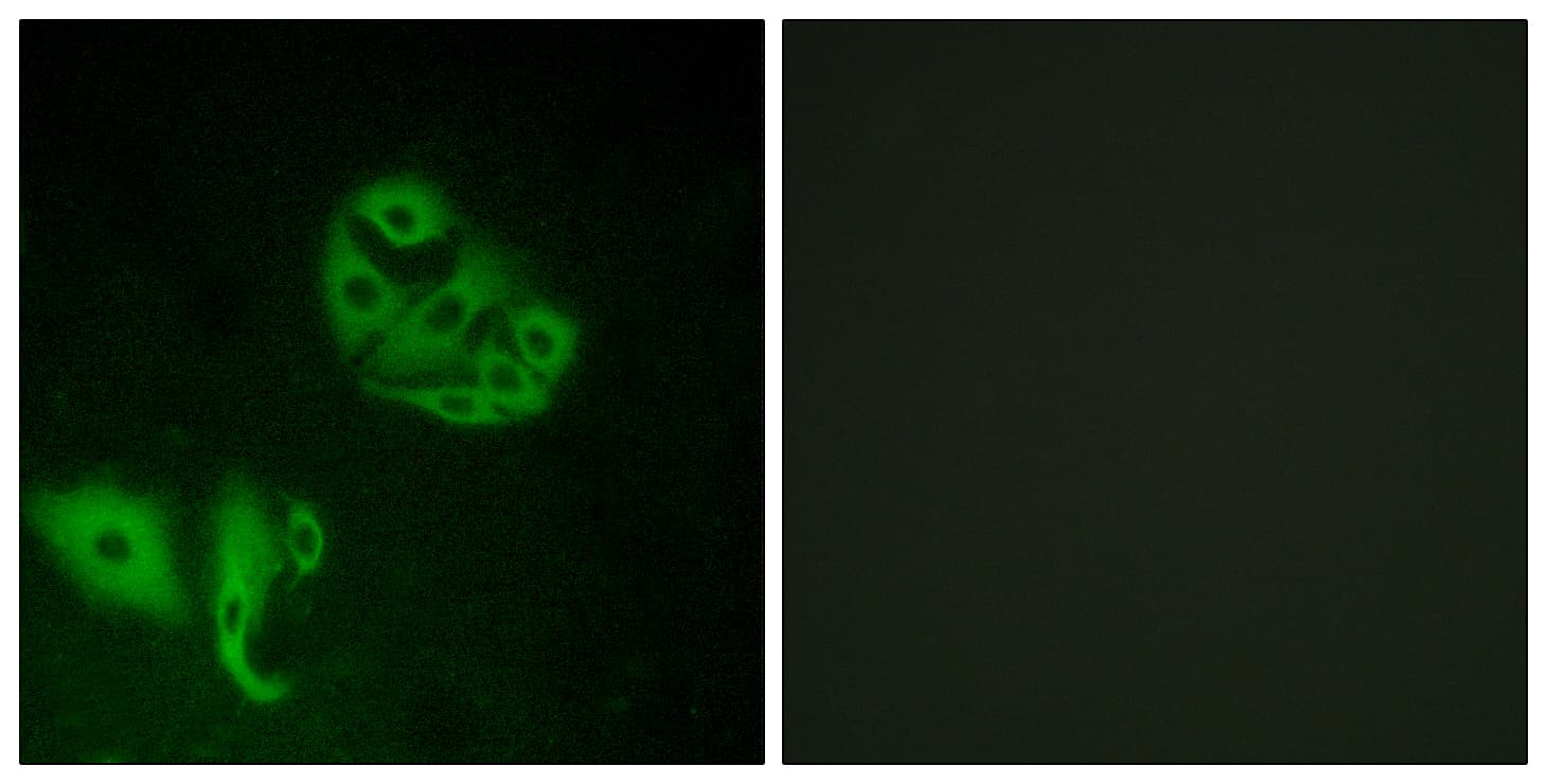 IHC-plus™ GPR20 Antibody (aa291-340)