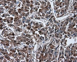 BHMT Antibody (clone OTI1E5)