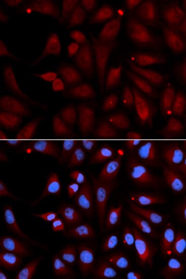 IHC-plus™ MAOB / Monoamine Oxidase B Antibody