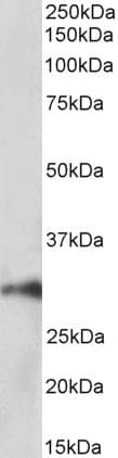 IHC-plus™ Polyclonal Goat anti-Human HOXA5 Antibody (IHC, WB)