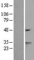 WDFY1 Protein (Over-Expression Lysate Myc-DDK (Flag))
