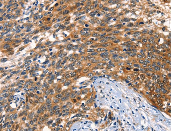 AGO1 / EIF2C Antibody