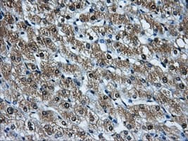 HDAC10 Antibody (clone OTI7C3)
