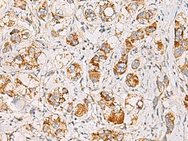 MMAB Antibody