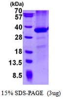 Mouse CD274 / B7-H1 / PD-L1 Protein (Recombinant His)