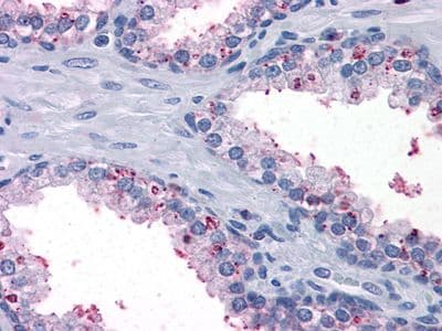 SDR9C1 / BDH1 Antibody (clone 1A5)