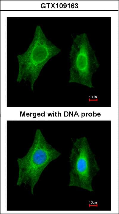 IHC-plus™ Polyclonal Rabbit anti-Human PSPH Antibody (aa1-175, IHC, WB)