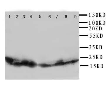 CYGB / Cytoglobin Antibody (aa50-68)