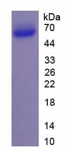 Mouse APP / Beta Amyloid Precursor Protein (Recombinant His)