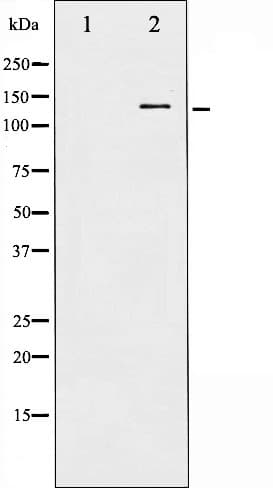 BCAR1 / p130Cas Antibody (phospho-Tyr410)