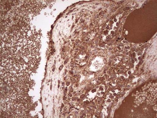 UBE2D2 / UBCH5B Antibody (clone OTI1D11)
