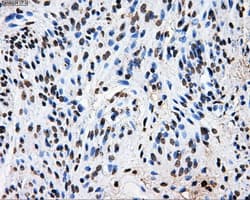 ATP5B / ATP Synthase Beta Antibody (clone OTI6C4)