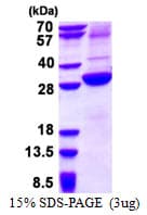 Human ASGR2 Protein (Recombinant His)
