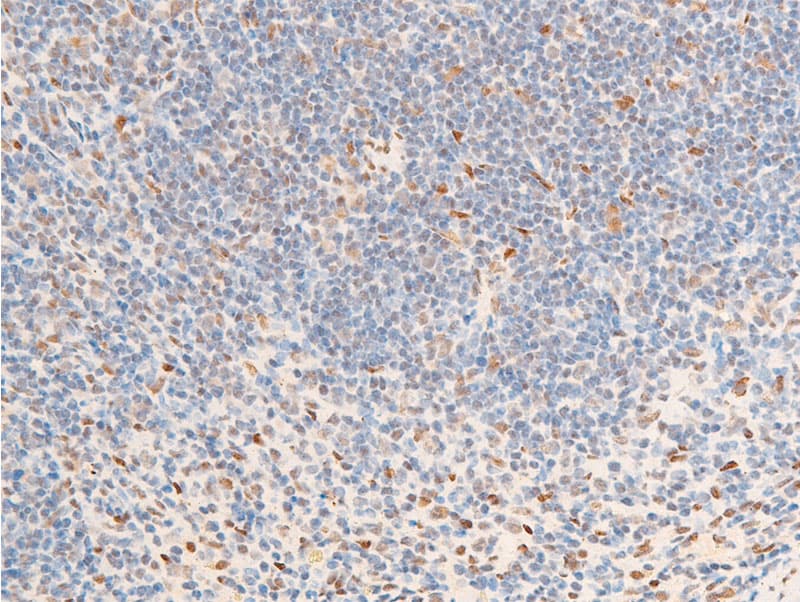 NR3C1/Glucocorticoid Receptor Antibody (phospho-Ser226)