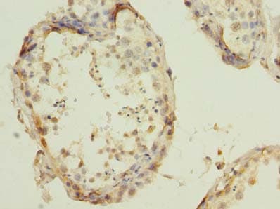 RBBP9 Antibody