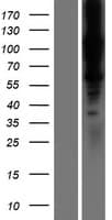 LOXL1 Protein (Over-Expression Lysate Myc-DDK (Flag))