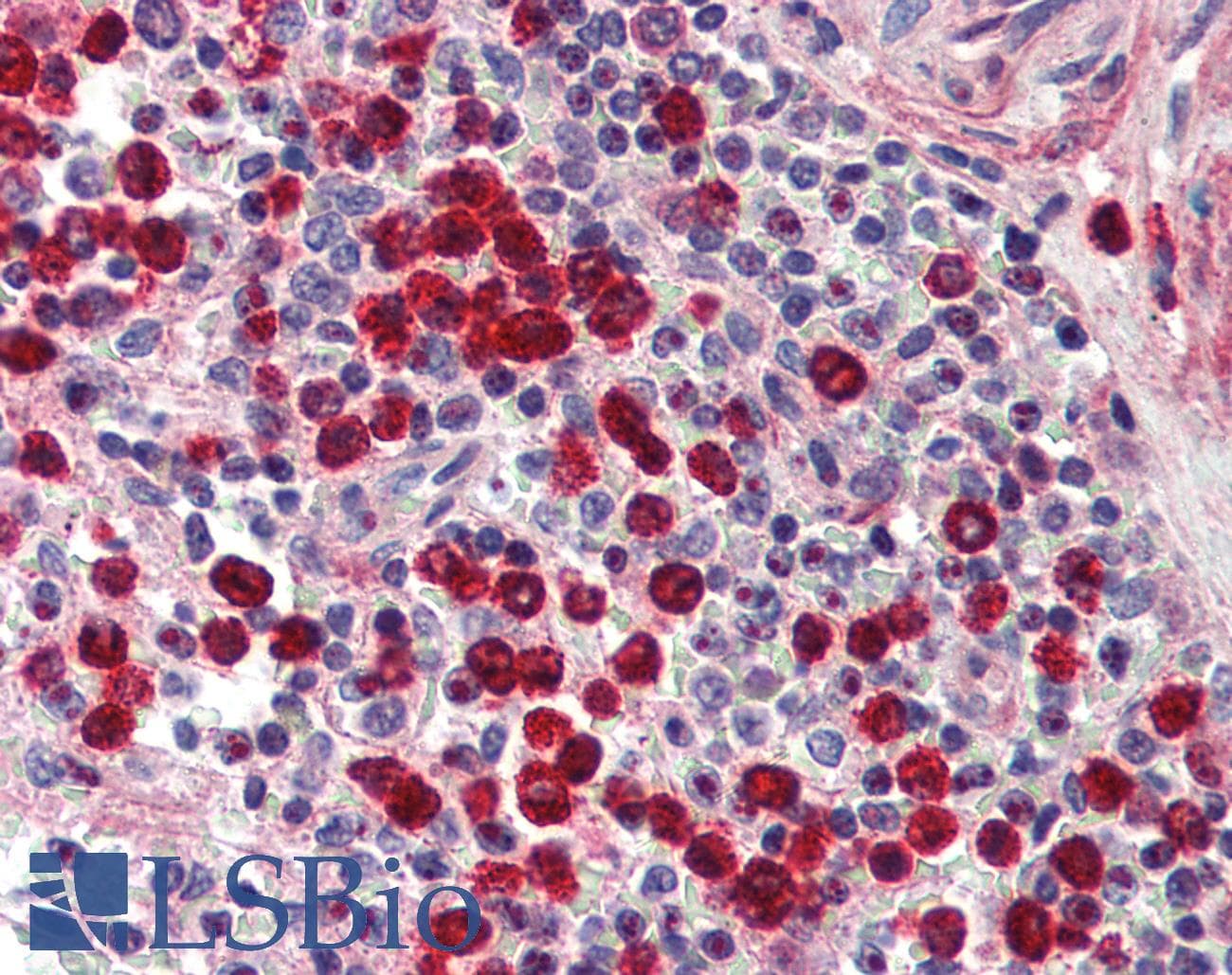 IHC-plus™ MMP9 / Gelatinase B Antibody
