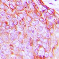INSR / Insulin Receptor Antibody (phospho-Tyr1361)