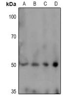 Polyclonal Rabbit anti-Human TPH1 / Tryptophan Hydroxylase Antibody (phospho-Ser58, IHC, WB)
