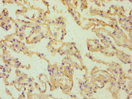 RALDH2 / ALDH1A2 Antibody (aa1-180)