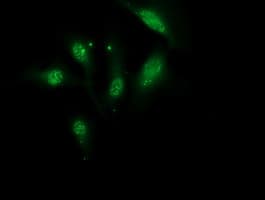 Monoclonal Mouse anti-Human MGLL / Monoacylglycerol Lipase Antibody (clone OTI1H1, IHC, IF, WB)