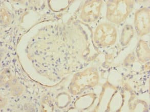 Polyclonal Rabbit anti-Human INPP5J / PIB5PA Antibody (IHC)