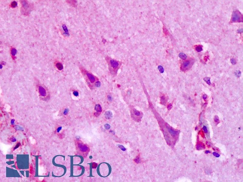 IHC-plus™ HTR1F / 5-HT1F Receptor Antibody (C-Terminus)