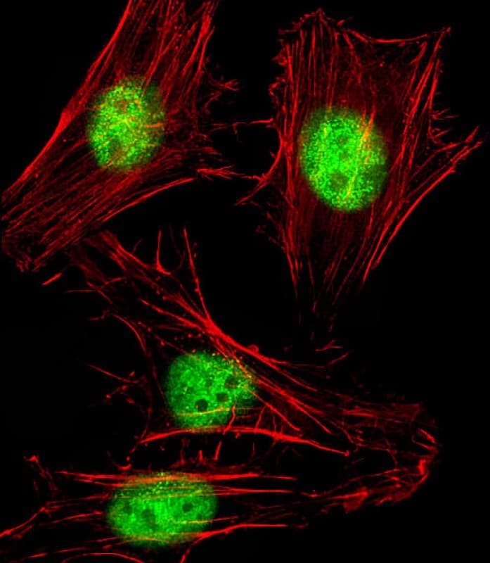 SNW1 / SKIP Antibody (aa464-497)