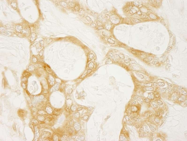 Polyclonal Rabbit anti-Human DIAPH1 Antibody (aa1200-C-term, IHC)