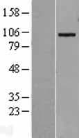 ADAM19 Protein (Over-Expression Lysate Myc-DDK (Flag))