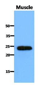 IHC-plus™ SARA2 / SAR1B Antibody (clone AT1C7)